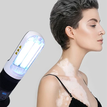 2022 Új fejlesztésű 311nm UVB lámpa vitiligóhoz UVB fényterápiás készülékek arctest vitiligo kezelésére